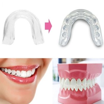 보급형 형상기억마우스피스 치아맞물림 가드 마찰마모 (WFFUOEY)