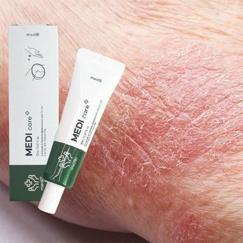 건조한 피부 건선 가려움증 간지러움 땀띠 습진 연고