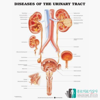 [오늘출발]인체해부도 3D차트 병원액자 9797 비뇨기과 요도 질병 54X74cm 액자옵션