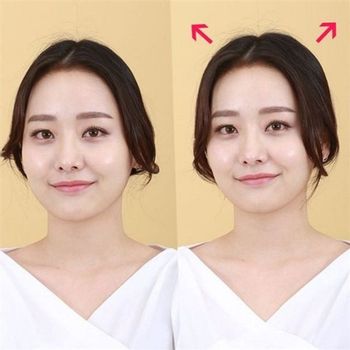 여성 헤어 똑딱이 증모 앞머리 커버 연출 간편 액세서리 웨이브 증모제 내추럴 클립 새치 탈모