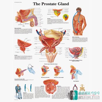 [오늘출발] 3B Scientific 비뇨기과 남성 전립선 인체해부차트 VR1528 Prostate 병원액자